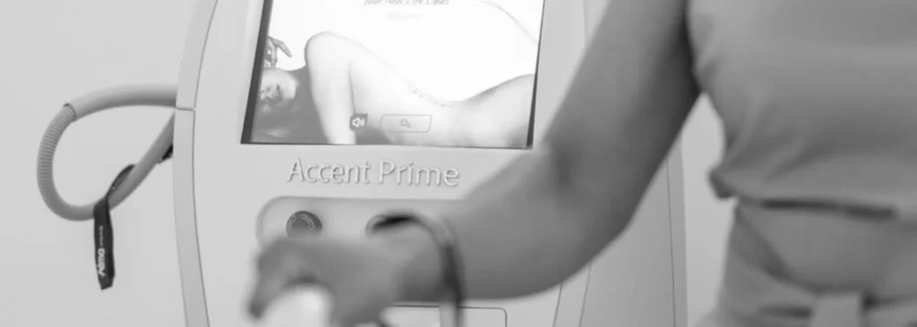 Gu&iacute;a de cuidados de Accent Prime: &iquest;C&oacute;mo preparar tu piel y maximizar tus resultados?