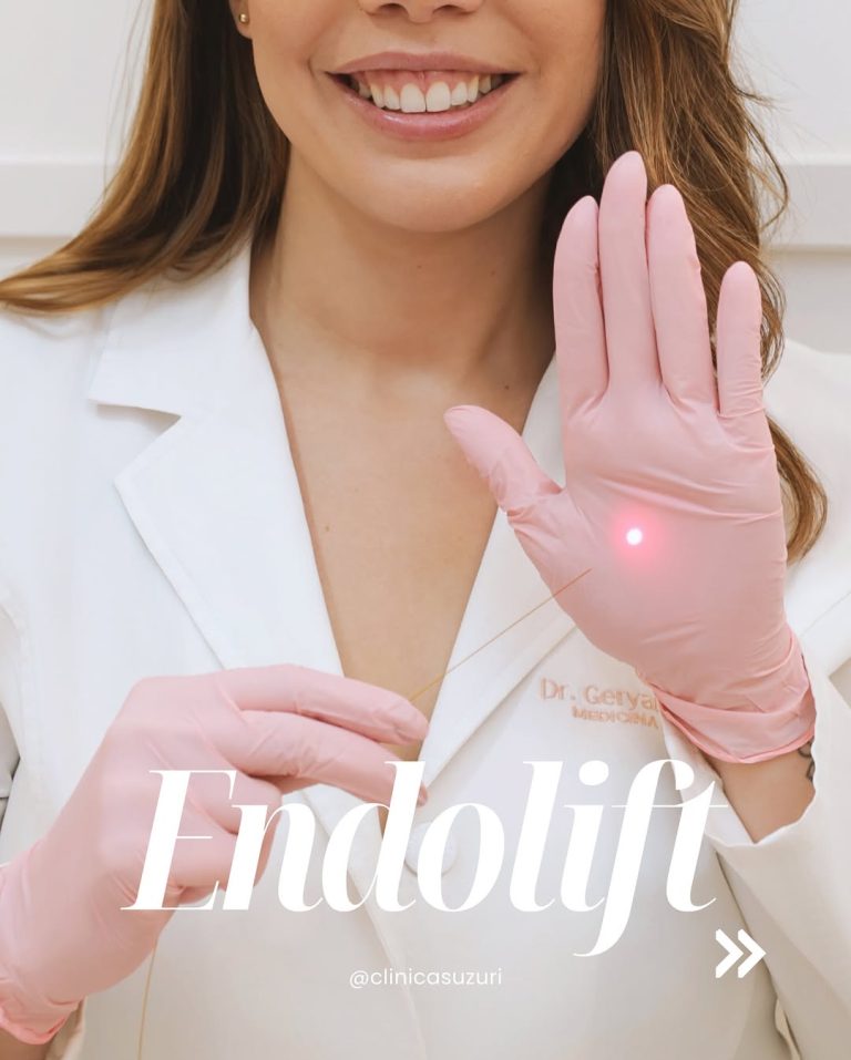 endolift clinicas uzuri